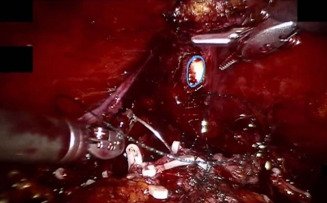 Urethra — example 2